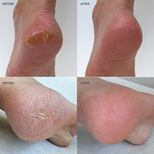 Load image into Gallery viewer, Heel Repair Duo, Lavender
